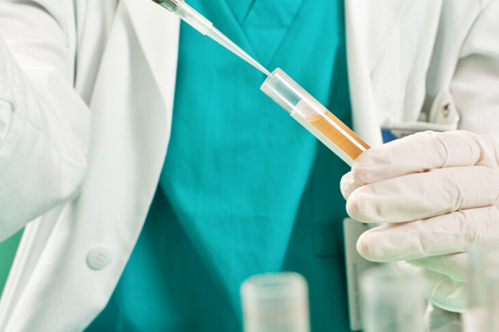 Scientist testing bloody urine.