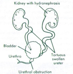 Hydrophrenosis