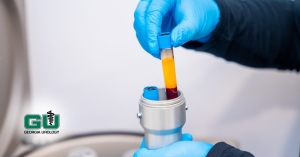 Provider using centrifuge for Platelet rich plasma shot