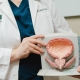 Dr. Kristi Hebert holding 3D male bladder diagram