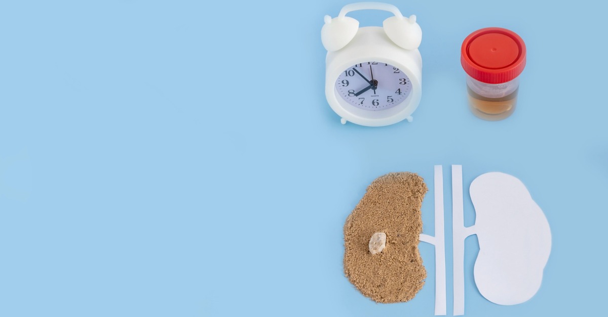 model of human kidney made of paper and sand with a stone and a clock