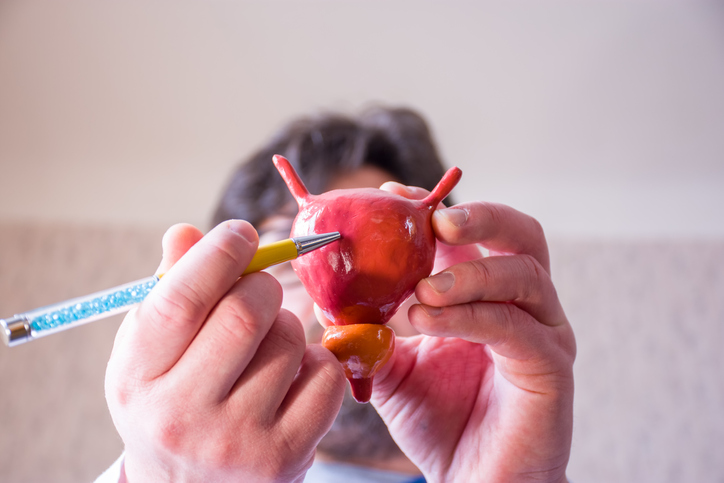 Doctor on defocused background holds in his hand anatomic model of bladder with prostate, pointing with pen in hand on urinary bladder in foreground. Localizing pathology, illness or problems, thinking about Urodynamic Testing.