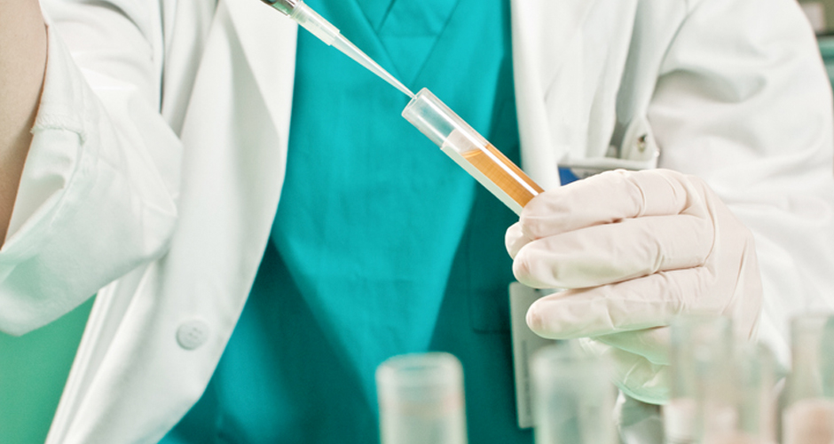 Scientist testing bloody urine.